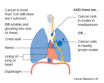 What is stage 3 lung cancer?